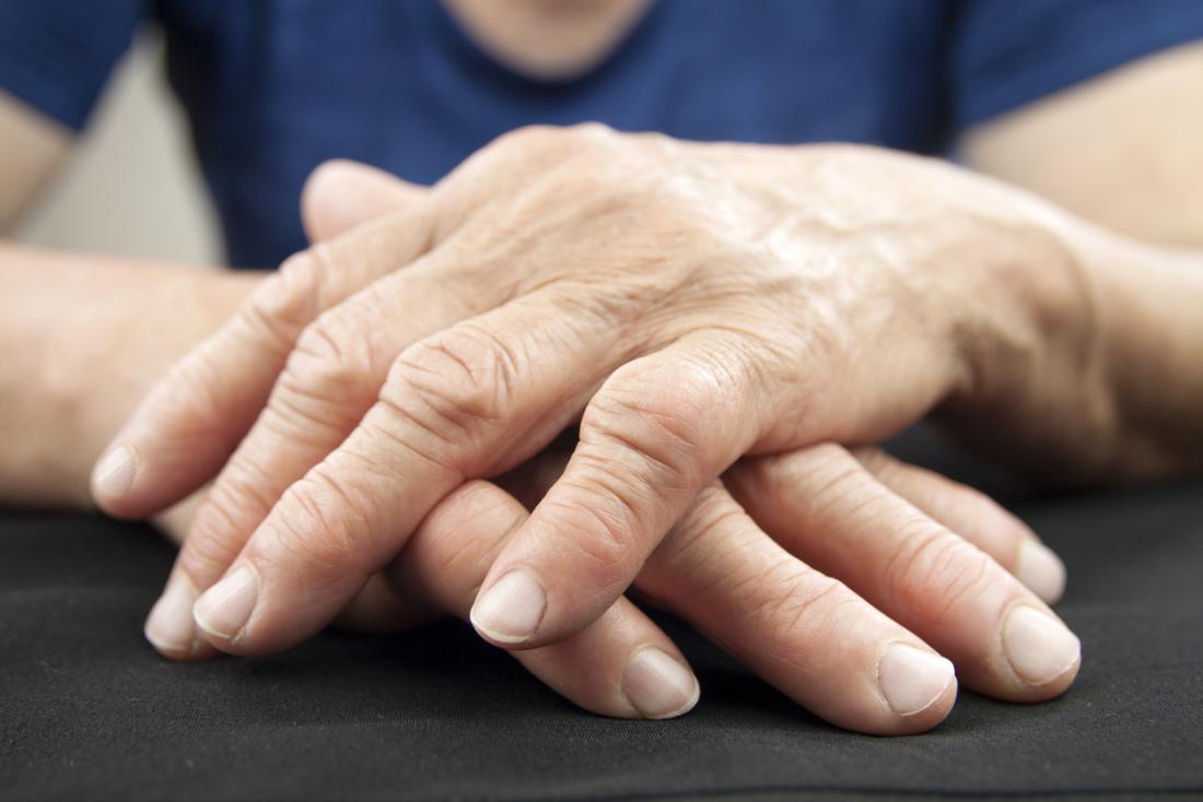 Exercises for Arthritic Hands - Colorado Pain Care