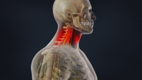neck pain pain management denver co