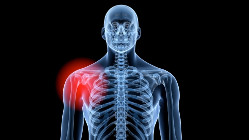 shoulder pain management denver co