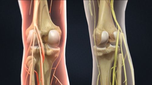 knee joint injections pain doctors denver co