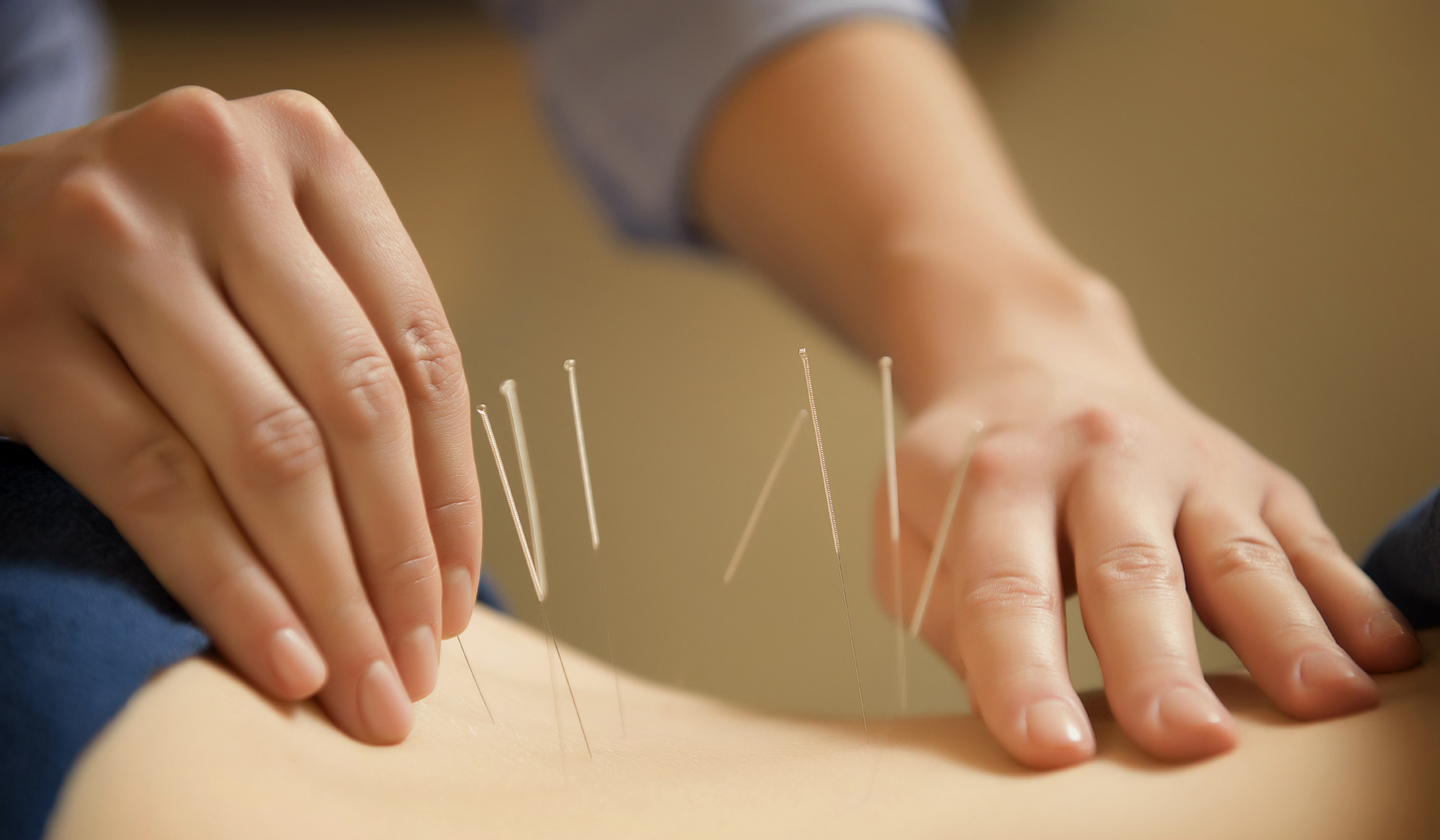 acupuncture within a multi-disciplinary approach to treating pain without opioid medications.