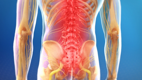 low back pain physicians denver co